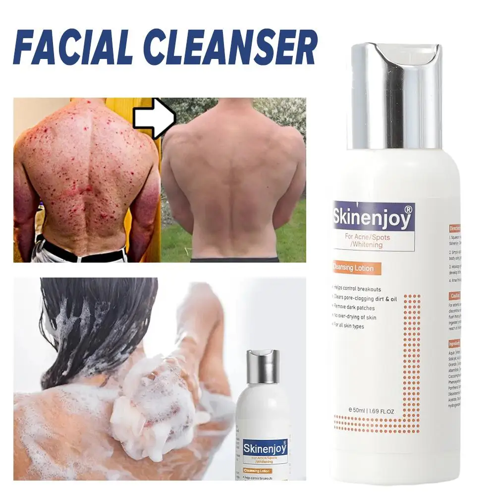 

Whitening Facial Cleanser Fade Dark Pigmentation Dullness Deep Moisturizing Skin Exfoliation Lotion Cleansing Cleaning Brig X2V7