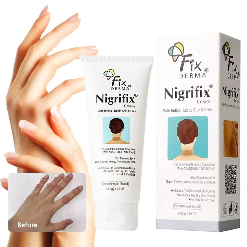 Crema de terapia de acantosis Nigricans, Corrector de manchas oscuras, crema de terapia Nigricans, crema Fixderma Nigrifix