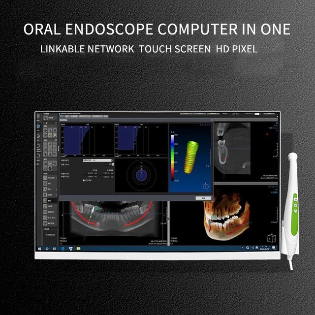 Dental endoscope computer in oneTouch screen computer oral viewer all-in-one medical HD endoscope