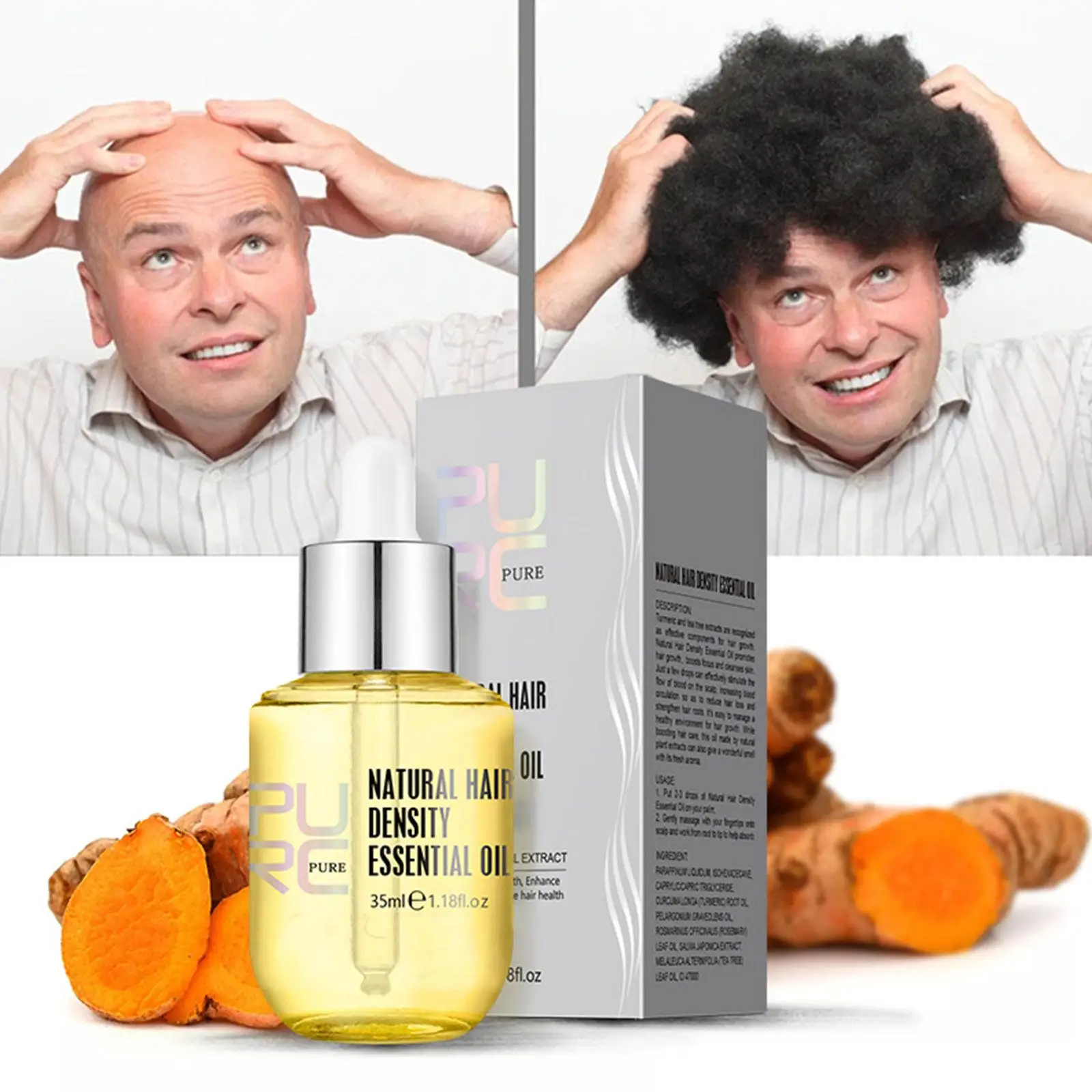 PURC 35ml Ginger Essence Oil Men Women Hair Loss Thinning Treatment Liquid Fast Regrowth Hair Density Essential Oil hair growth serum hair growth spray hair growth cream