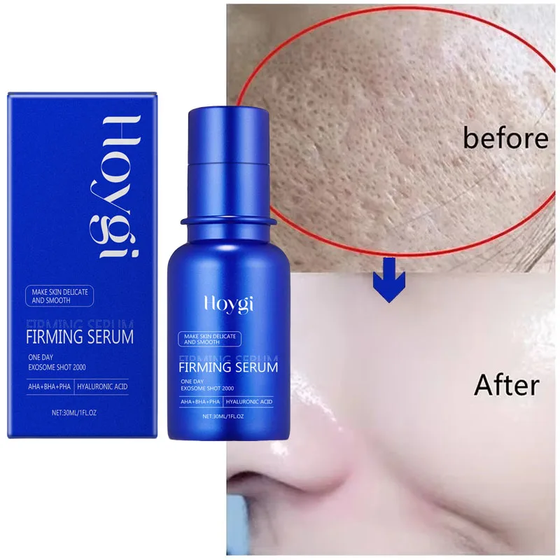 Facial Serum Facial Essence Blue Microneedle Shrink Pores Whitening Lifting Firm Fine Line Moisturise Melanin Remove Skin Care Product