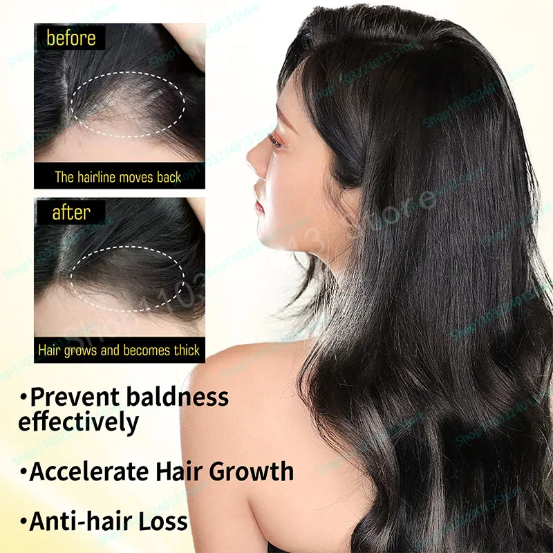 Description Picture 5 of item7 Days Fast Hair Growth Ginger Growth Hair Oil Treatment Anti Hair Loss Men Women Scalp Treatment Serum Products Beauty Health