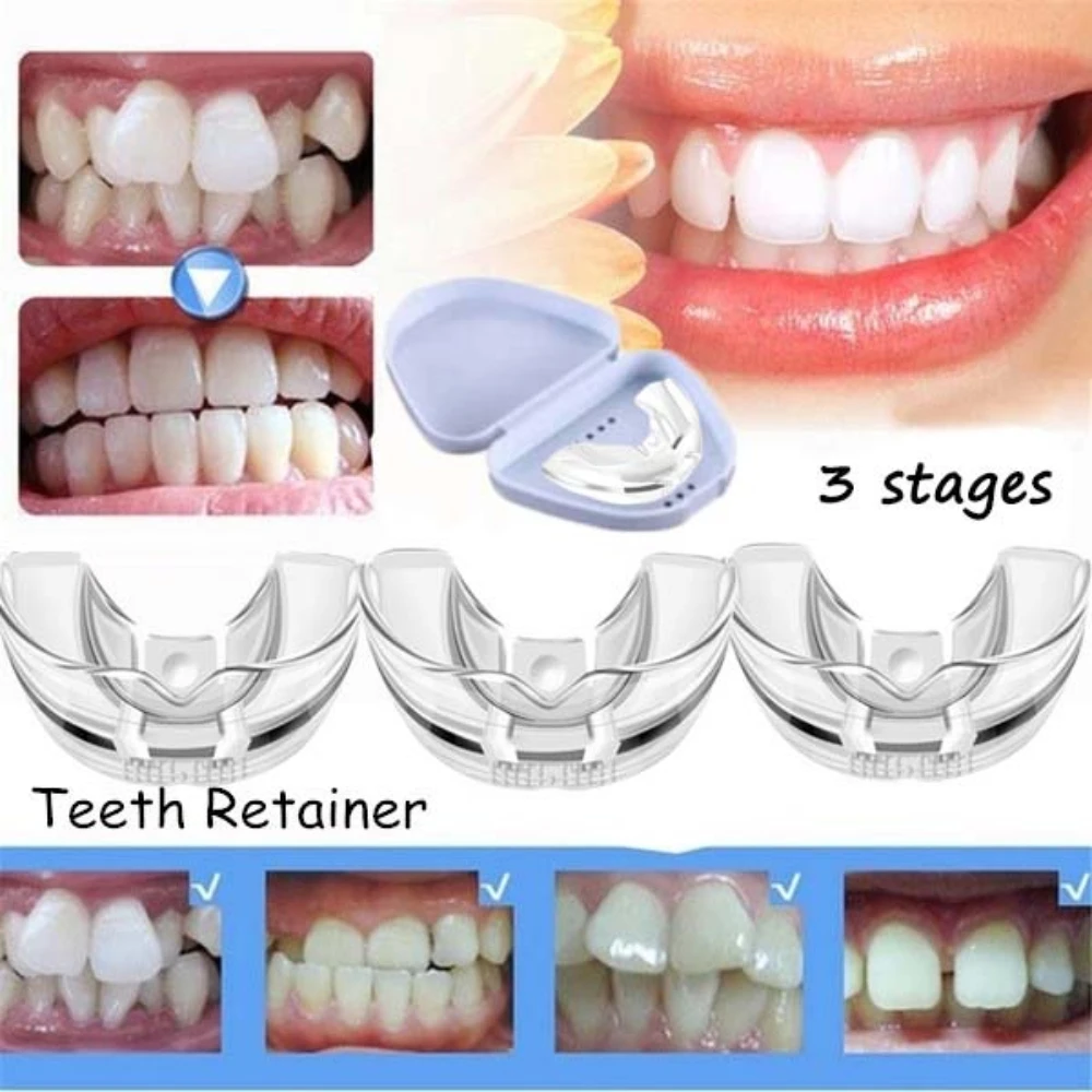 345PcsDentalBracesOrthodonticTeethTrainerSetforAdults
