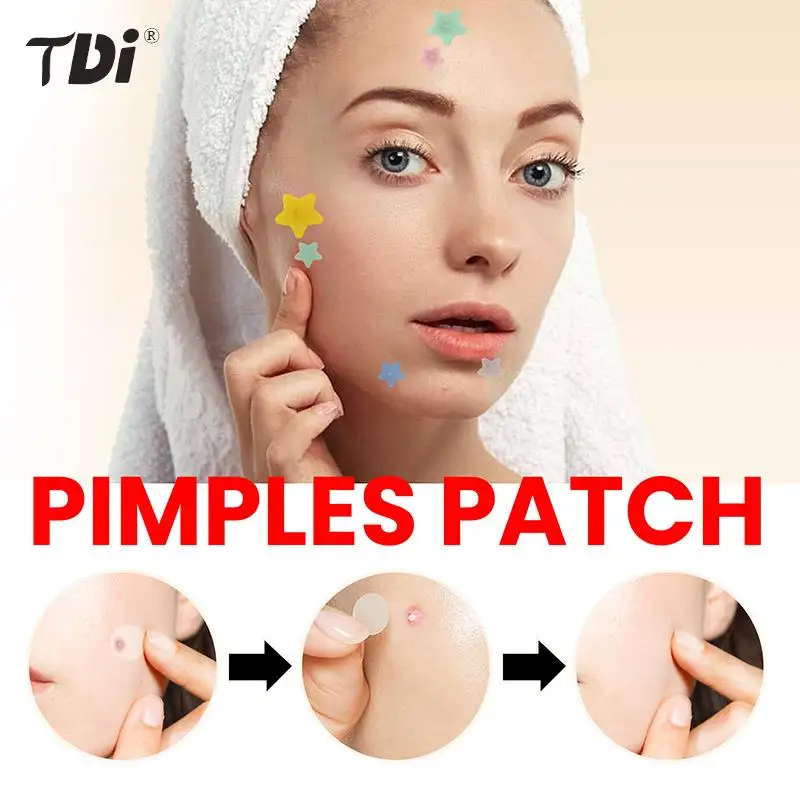 

200Pcs Acne Pimple Patch Sticker Waterproof Acne Treatment Pimple Remover Tool Blemish Spot Facial Mask SkinCare Hidden Pimple