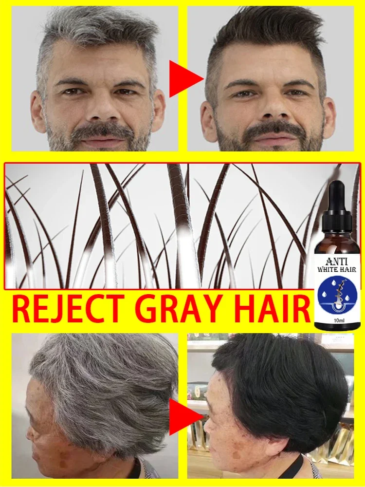 Tueur de cheveux blancs, &eacute;limine les cheveux gris et restaure la couleur naturelle en 7 jours
