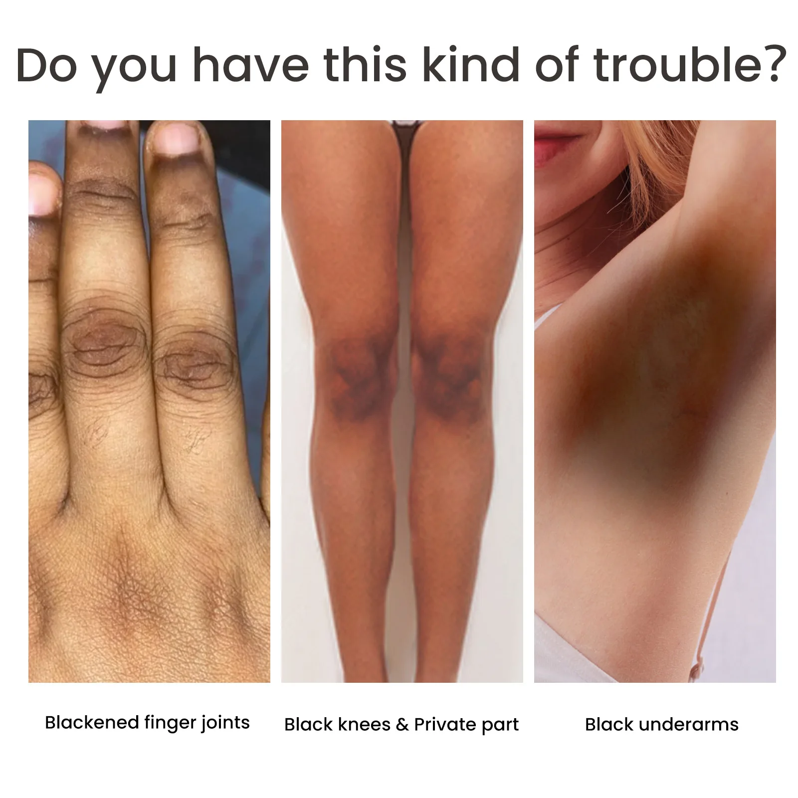 Body Bleach Serum Improve Dull Dark Skin Lightening Lip Armpit Elbows Ankles Thigh Knee Intimate Areas Private Whitening Essence 4