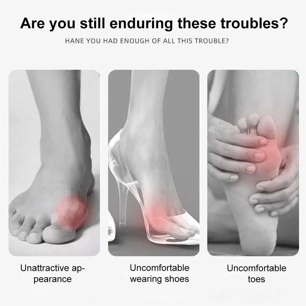 Toe Corrector Silicone Bunion Corrector Toe Separator Bunions Toe Corrector Valgus for Finger Separator Hallux Valgus Comfort