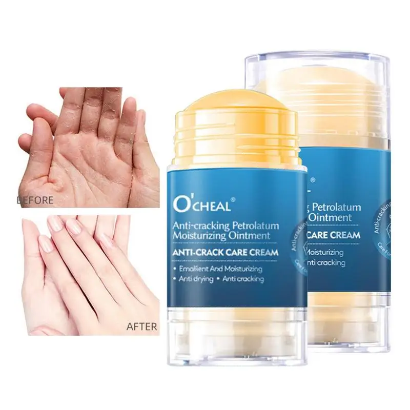 

Антивозрастной крем для ног с трещинами, восстанавливающий крем для пятки с трещинами, удаление омертвевшей кожи, уход за ногами