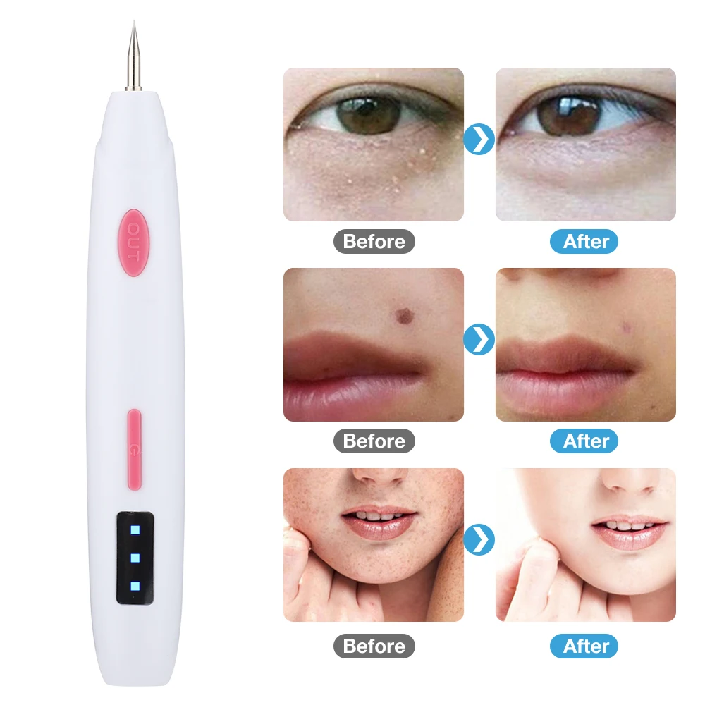Laser Plasma Pen Skin Tag Freckle Black Dot Papilloma Warts Mole Pimples Tattoo Removal Beauty Care Tools