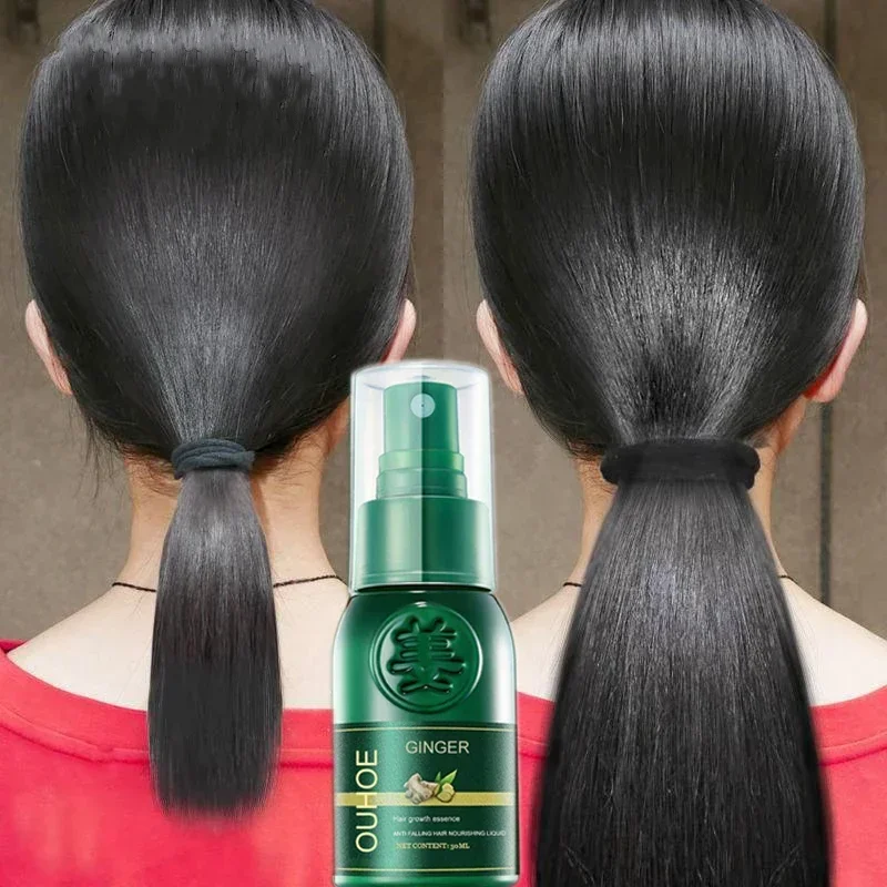 Ginger Hair Growth Sprays Products Fast Grows Nourish Damaged Hair Care Natural Anti Loss Serum Prevent Baldness Treatment