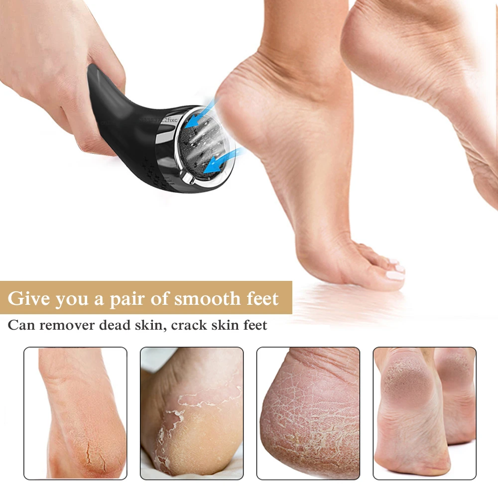 Foot Dead Skin Remover Electric Callus Remover Feet Vacuum File