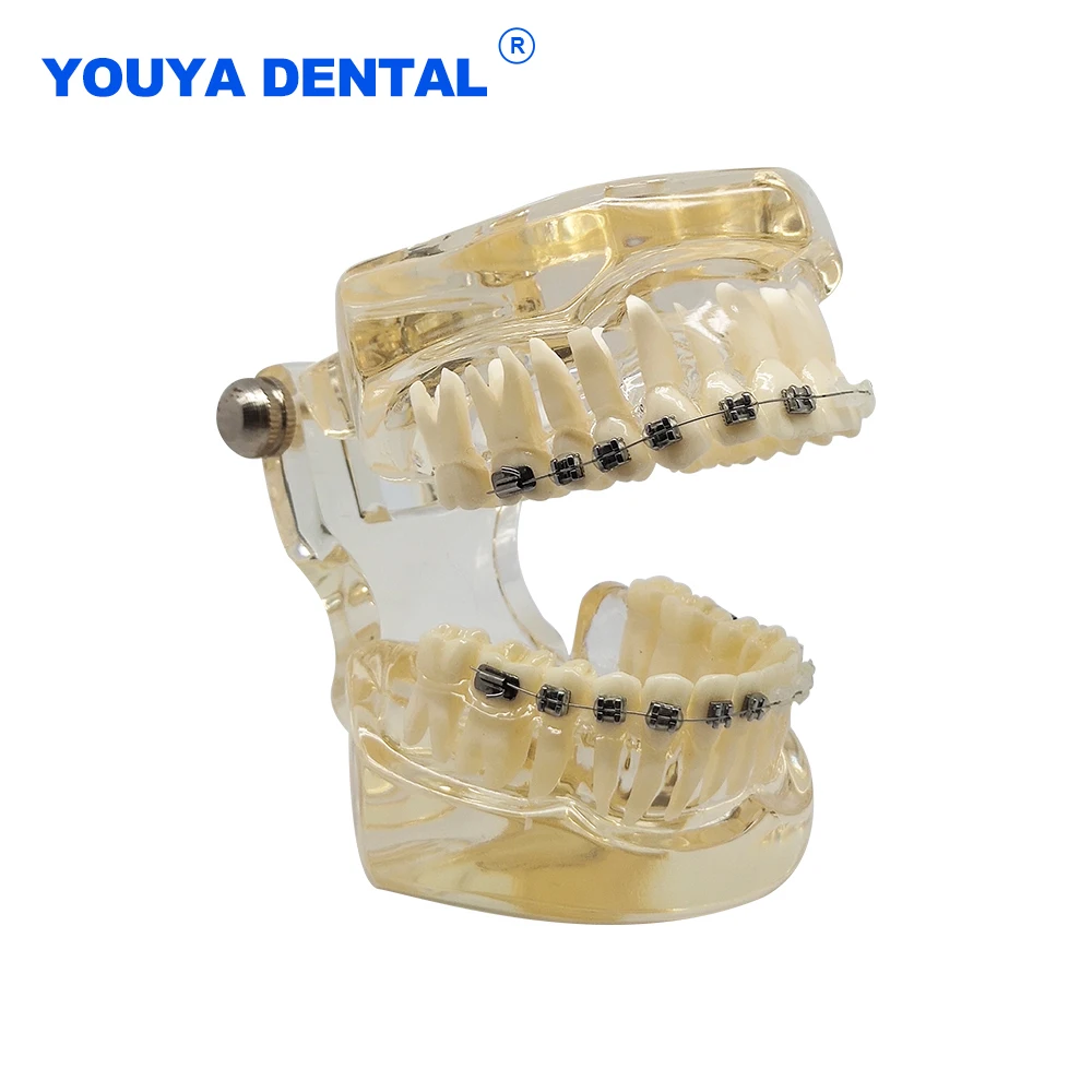 Orthodontic Implant Gum Tooth Models Metal Ceramic Braces Resin