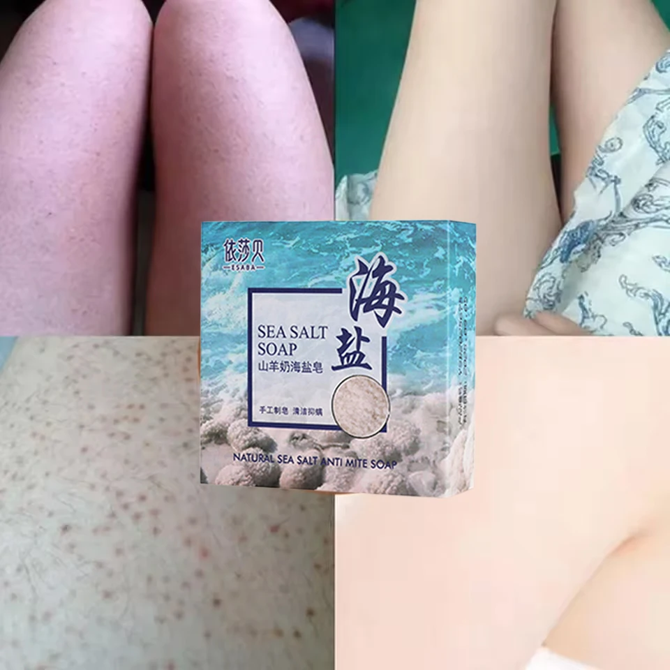 ملح البحر الجسم إزالة حب الشباب الصابون علاج الوجه...