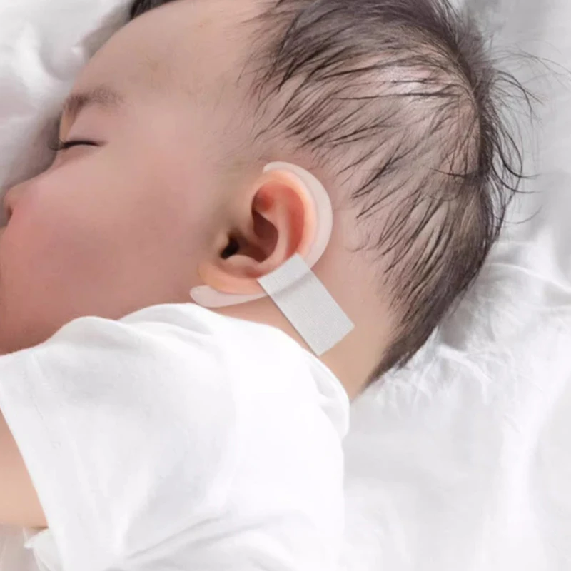 Correcteur D'Oreilles En Silicone Auto-adhésif, Patch De Correction Pour Oreilles Saillantes, Pour Bébé, Nouveau-né Et Enfant