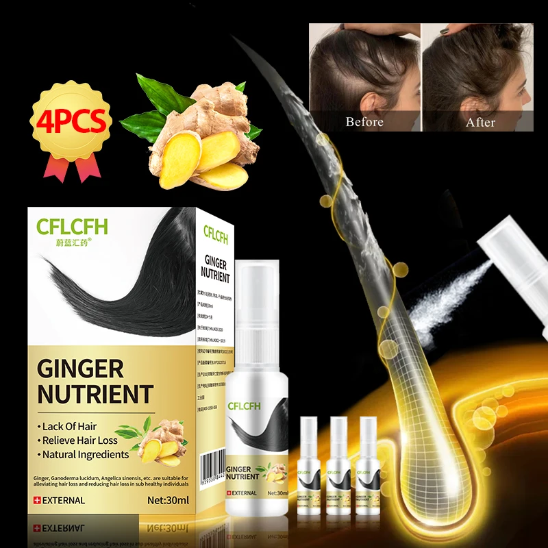 

Hair Growth Spray Ginger Ganoderma Lucidum Products Anti Hair Loss Treatment Scalp Hair Regrowth Care Liquid for Men Women