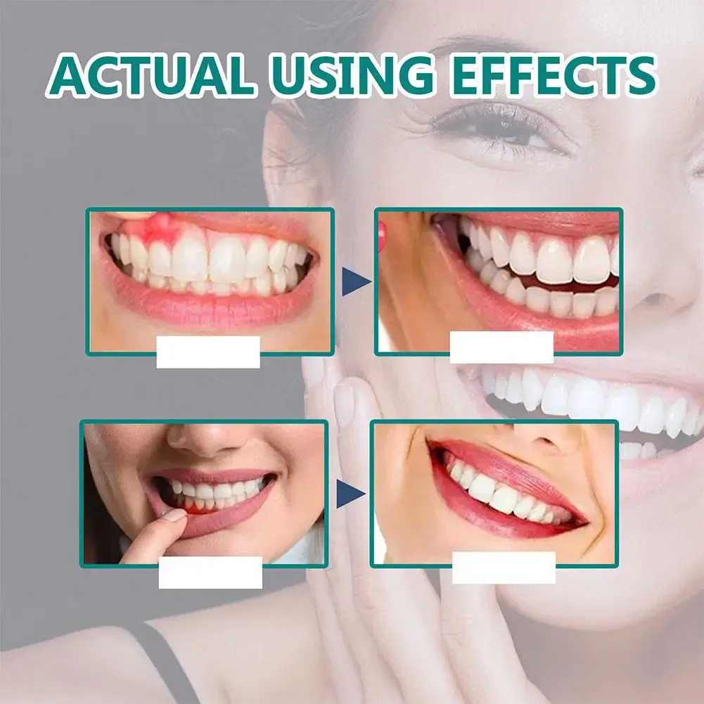 Eelhoe Gum Repair Drops Clean Teeth Whitening Remove Soothe 30ml Oral Care gum repair drops