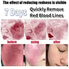 7 Day Repair Redness Serum Sooth Itching Sensitive Skin Improve Rosacea Shrink Pore Smooth Nourish Facial Skin Korean Cosmetics 3