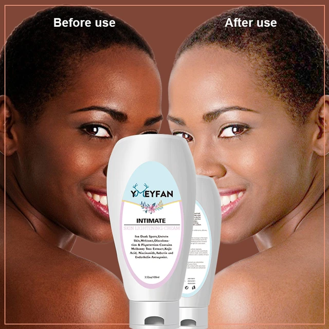 Skin Whitening Cream For Dark Skin Bleaching Africa Snow White Lightening  Face Body Lotion For Sensitive Area Elbows Underarm - Body Creams -  AliExpress