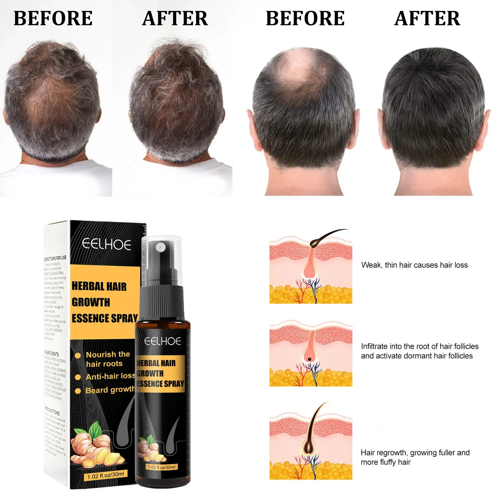 Description Picture 4 of itemSdatter Hair Growth Essence Spray Ginger Anti Hair Loss Treatment Scalp Dry Damaged Beard Regrowth Care Roller Set  Anti Falling