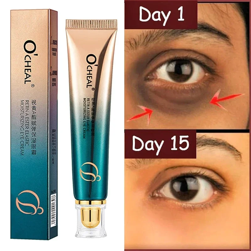 

Eye Cream Anti Wrinkle Retinol Fade Fine Lines Anti-dark Circles Remove Eye Bags Anti-aging Firming Eye Serum Eye Care Cream