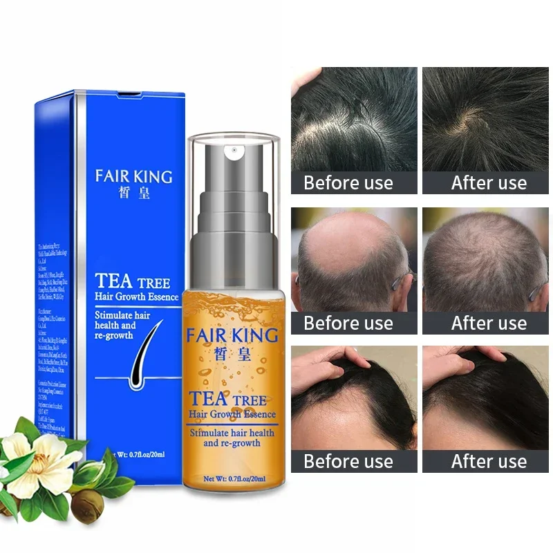 Fast Powerful Hair Growth Essential Oil Organic Natural Hair Loss Care Serum 20ML Hair Scalp Treatment Essence Tea Tree Extract