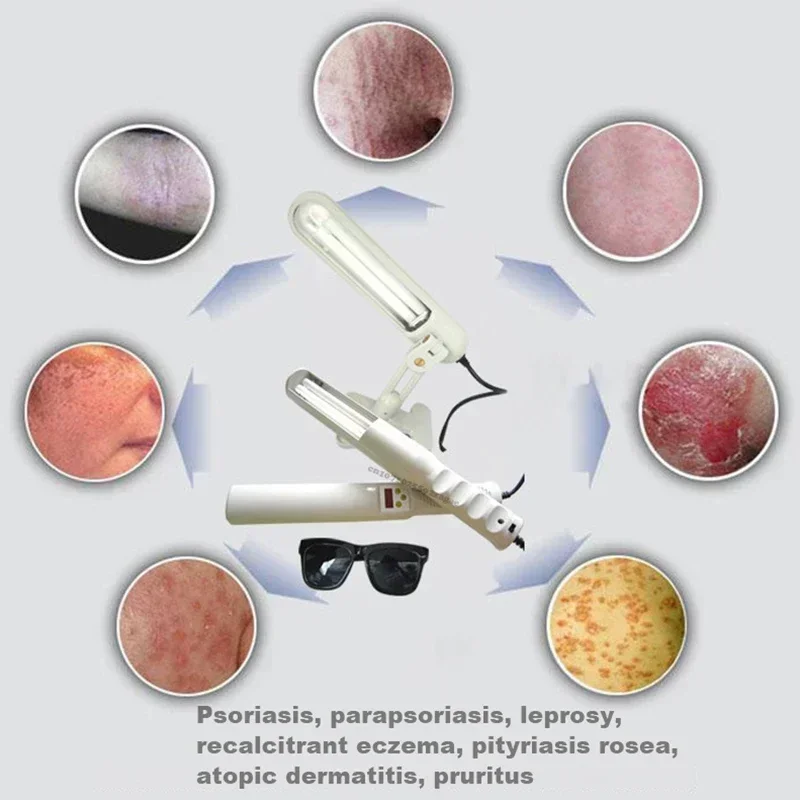 Household UVB 311nm Phototherapy Ultraviolet Rays Lamp for Psoriasis Eczema Relief 110V/220V Skin Care Support Device uv phototherapy lamp