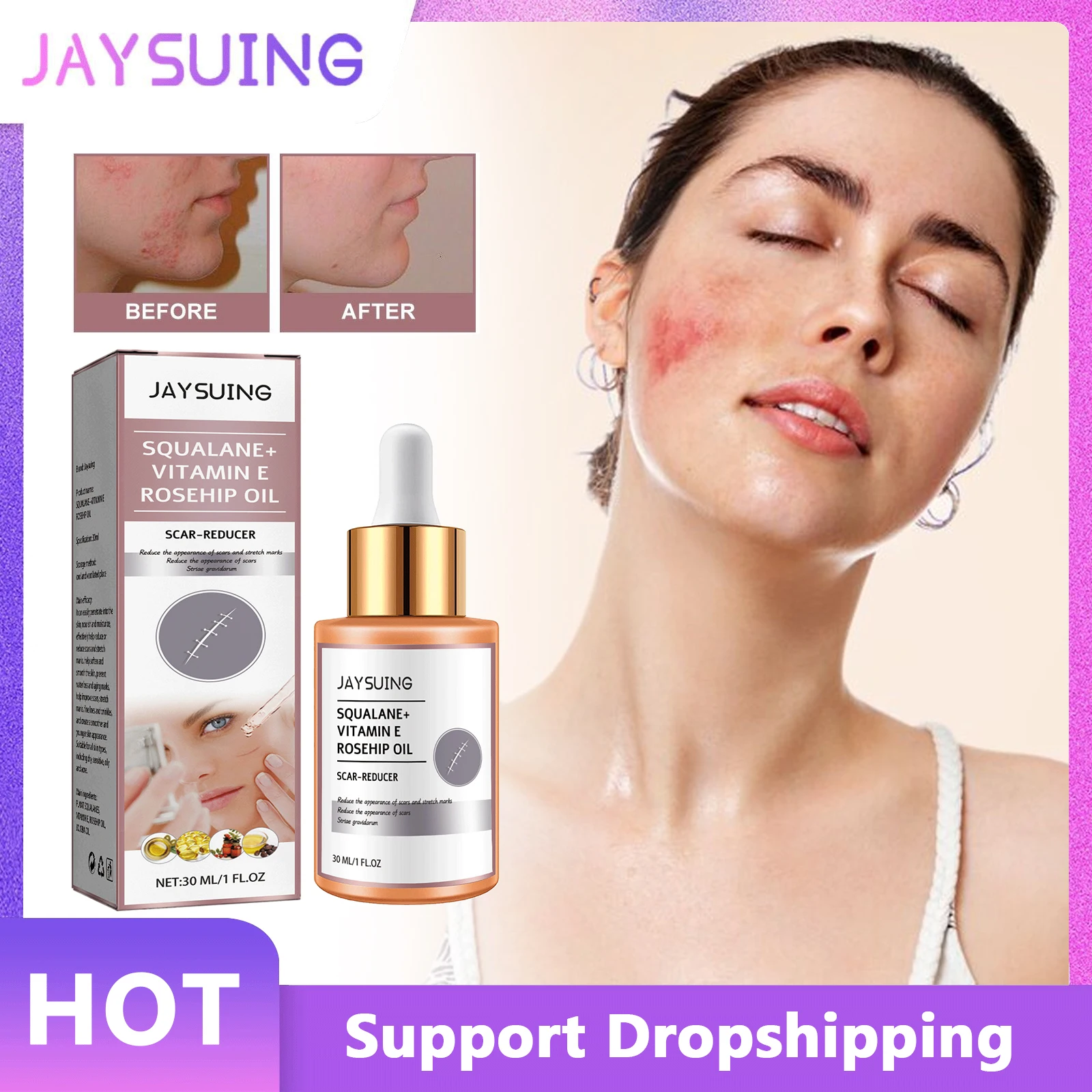 Jaysuing Scar Removal Rosehip Oil Antiaging Improve Stretch Marks