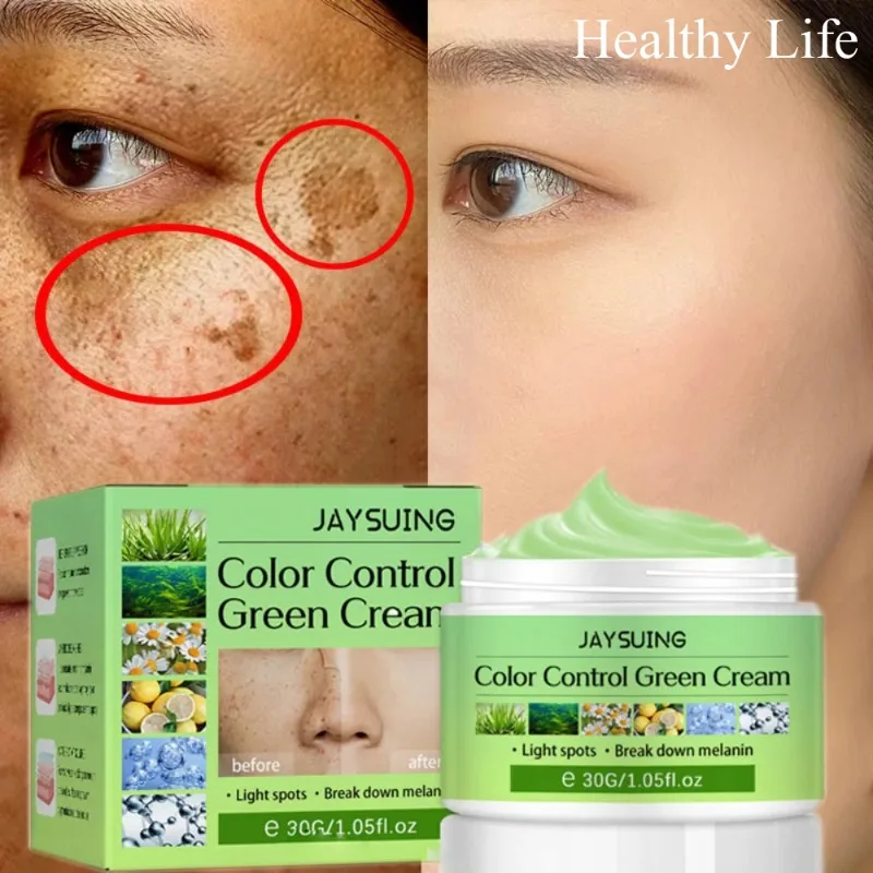 Remove Melasma Fade Spots Cream Women Whitening Freckles Cream Face Lightening Brighten Serum Moisturize Anti-aging Skin Care body acne removing serum body whitening essence fade acne dar spots remove acne marks moisturize skin care lotion