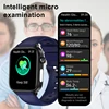 New For XIAOMI Men Women Micro Examination Smart Watch ECG+PPG Blood Lipids Uric Acid Bluetooth Call Health Monitor Smartwatches 5