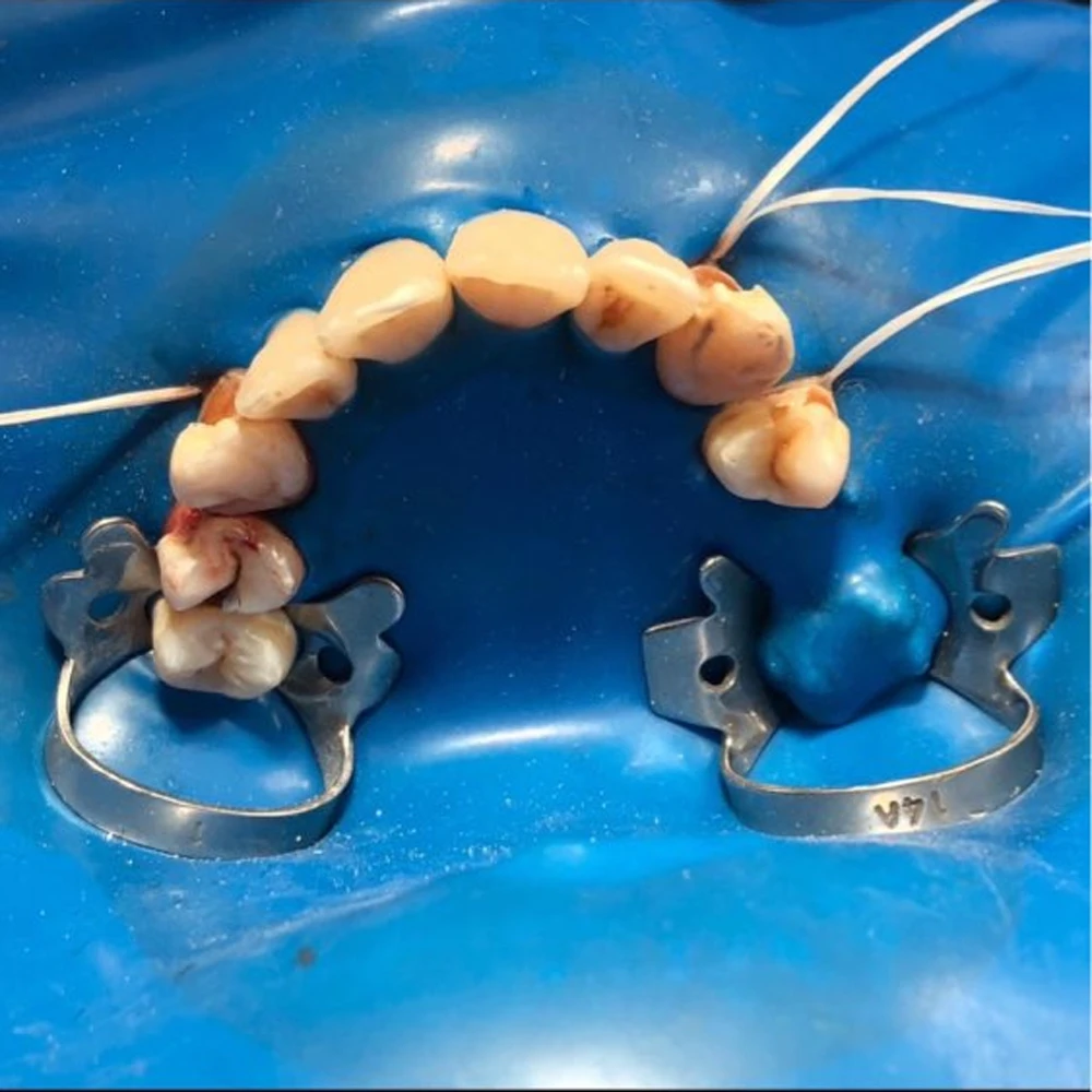 Gancio Per Diga CERKAMED Satin 27 Premolari Morsa Arrotondata - Foto 8