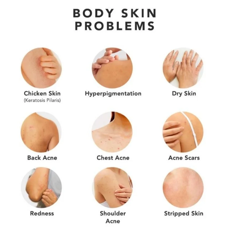 Рисунок 6 - 500 мл Отбеливающий Крем гель для