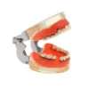 Dental Teeth Model  Dentist Teaching Model Demonstration Periodontal Disease Pathological For Patient Education Demo M4017 4