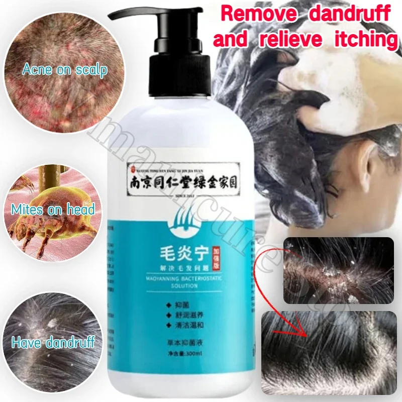 

300ml Amino Acid Mite Removal Dandruff Antipruritic Improvement Hair Follicle Acne Balance Scalp Oil Hair Care Repair Shampoo