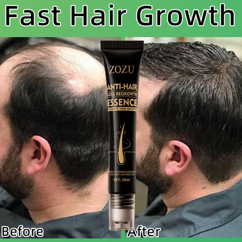 Prodotti per la crescita dei capelli Massaggio per capelli a crescita rapida Olio essenziale Anti perdita di capelli naturale Previene la secchezza dei capelli crespi danneggiati_voghion.com