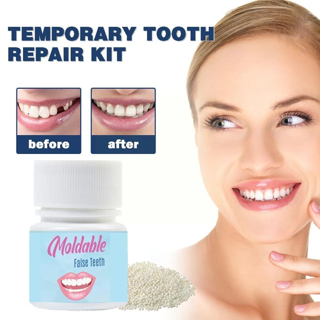 Sdotter New Resin Tooth Repair Kit 5g/10g/15g/20g FalseTeeth Gaps Temporary  Teeth Solid Glue Denture Adhesive Teeth Whitening To - AliExpress