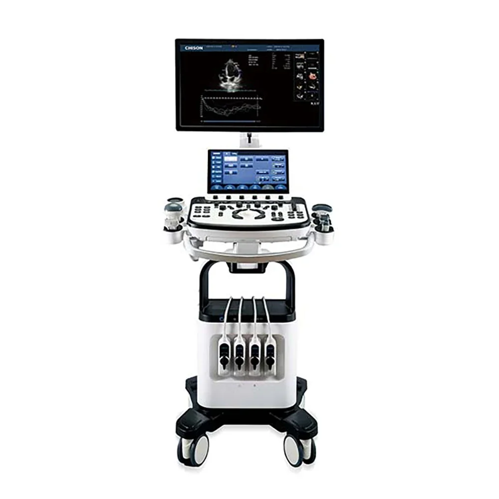 Рисунок 2 - Ультразвуковой сканер на колесиках с ЖК-дисплеем 23