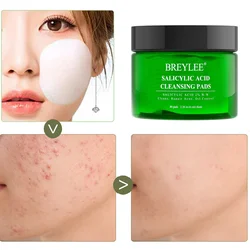 40pcs 2% Salicylic Acid Cotton Pads Removal Acne Blackhead Cleaning Mask Shrink Pores Oil Control Moisturizing Face Tablets Skin