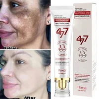 Crème blanchissante puissante anti-taches, éclaircissante pour la peau, élimine rapidement la Pigmentation de la mélanine, les taches foncées, soins coréens pour la peau du visage 1