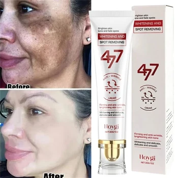 Dark Spot Whitening Cream 1