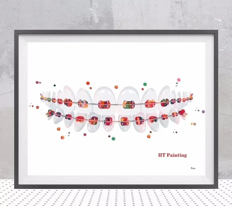 Modern Dental Art - Tooth Implant Anatomy Canvas Poster