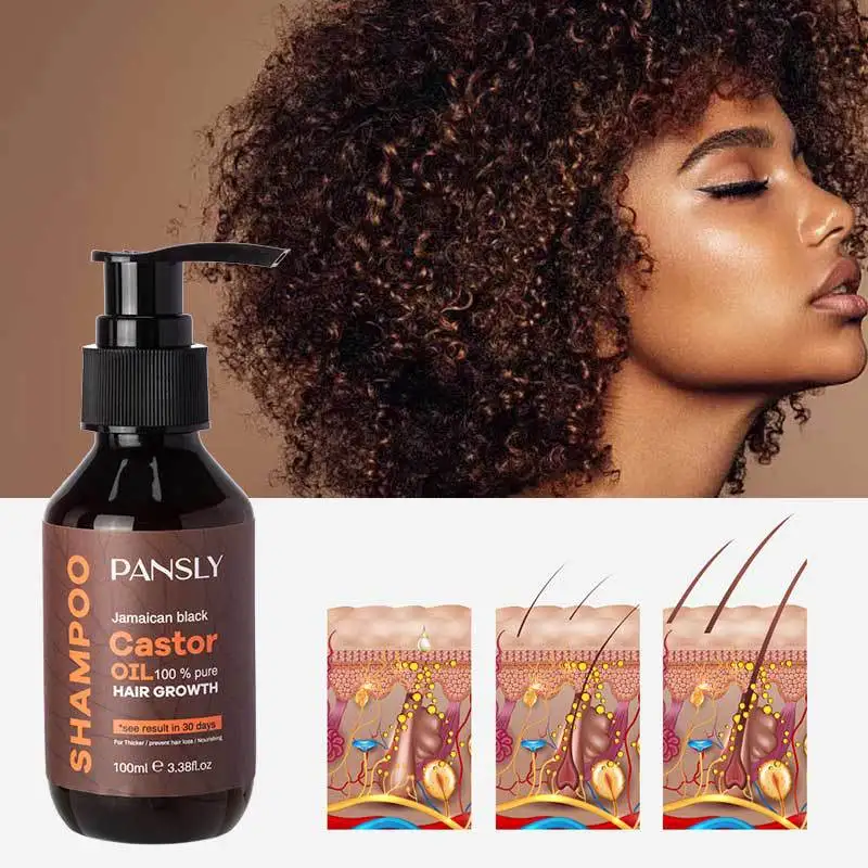 

Castor Oil Shampoo Deep Cleaning Anti-dandruff Antipruritic Oil Control Fast Hair Growth Effective Treatment for Hair Loss