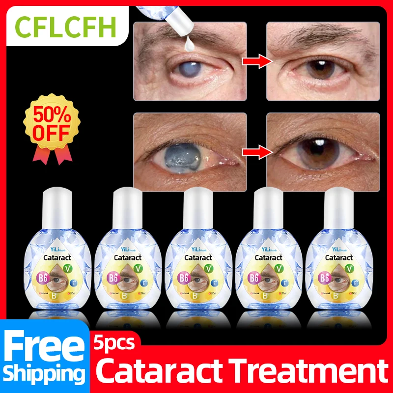 CataractTreatmentVitaminB6EyeDropsApplyToDryItchyEyesPain