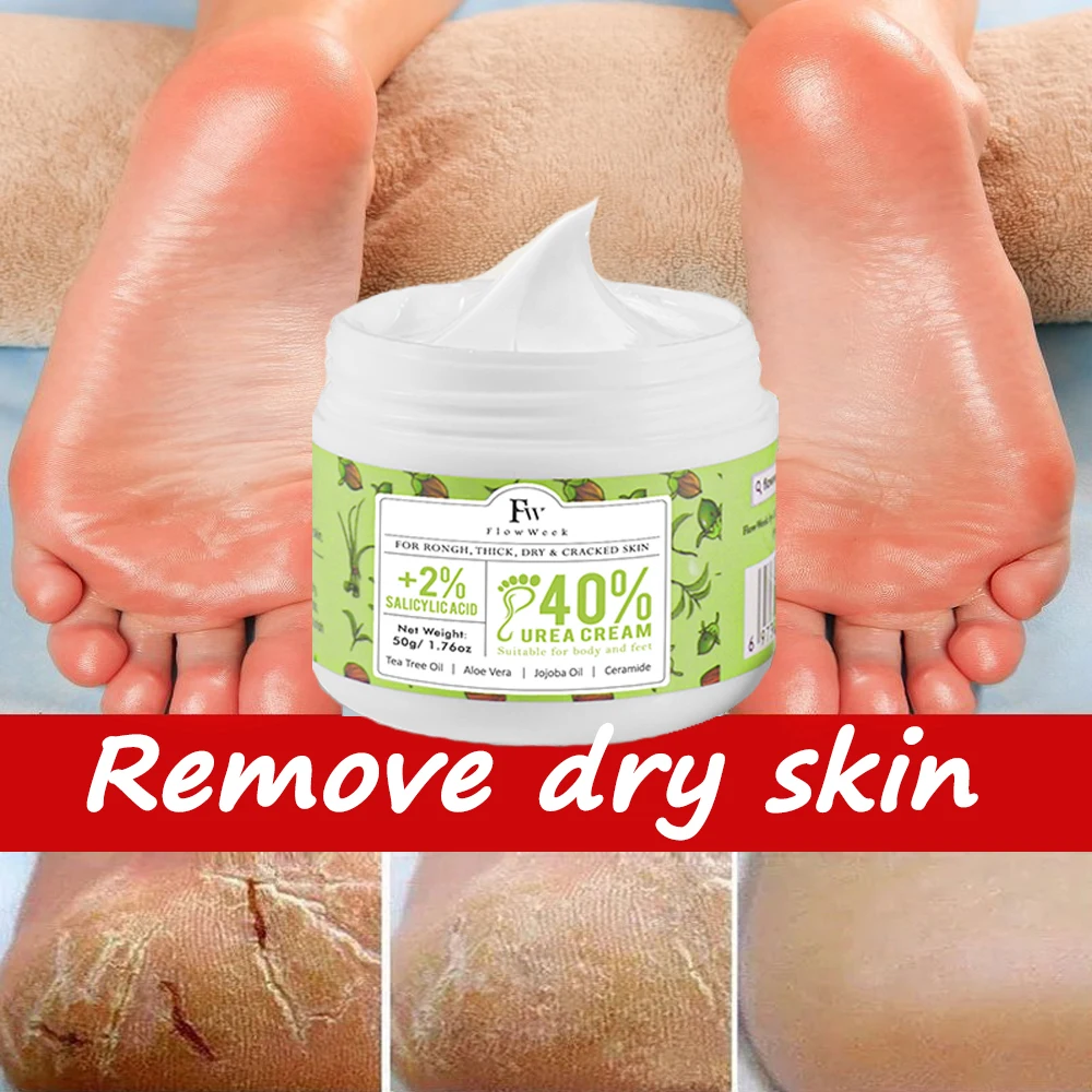 Urea Anti Drying Foot Cream Crack Heel Cream Removal Feet Calluses Dead Skin Repair Crack Skin Moisturizing Hydration For Foot