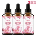 Lotus 3pcs