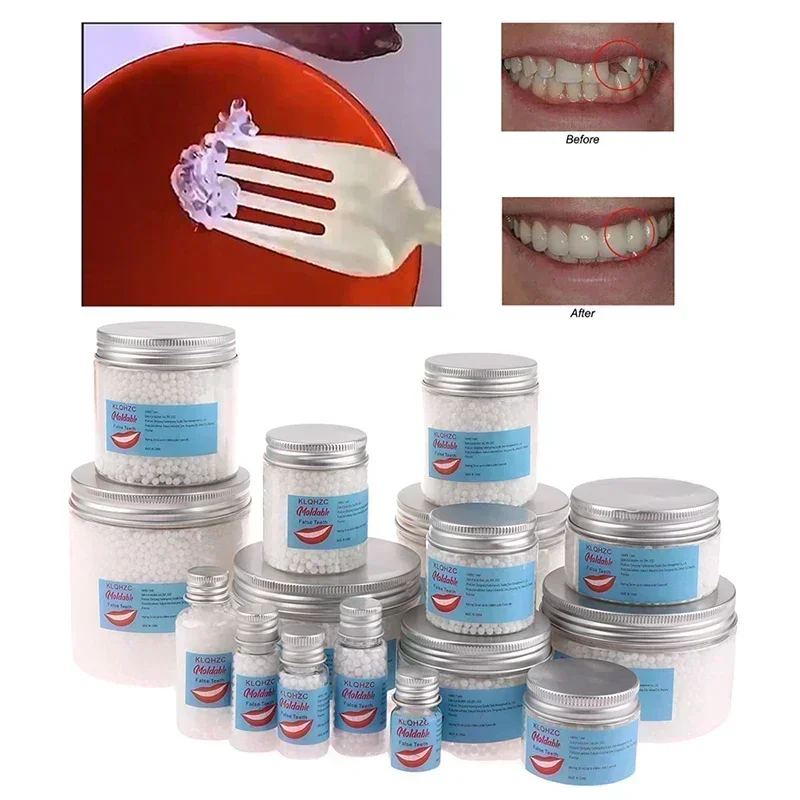 

Sdattor 5-50ml Resin Tooth Repair Glue Shapeable Teeth Gaps Filling Solid Temporary Teeth Repair Falseteeth Glue Safety Dental S