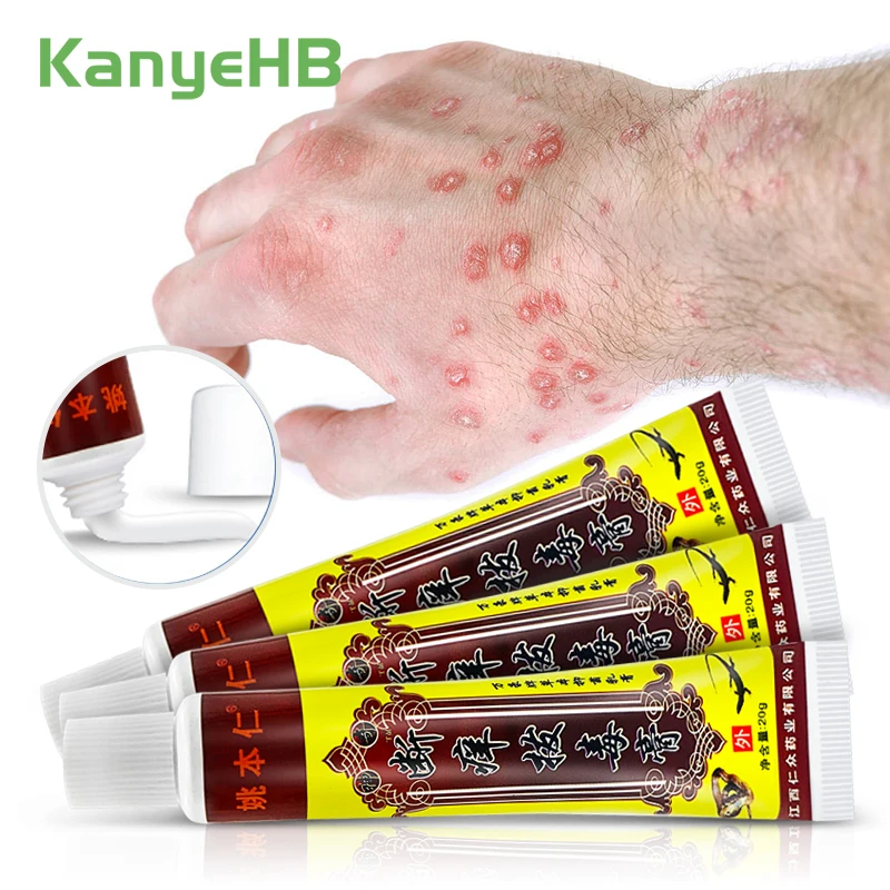

2-5pcs Chinese Medical Psoriasis Cream Herpes Eczema Dermatitis Allergy Treatment Relief Itchy Skin Antibacterial Herbs Ointment