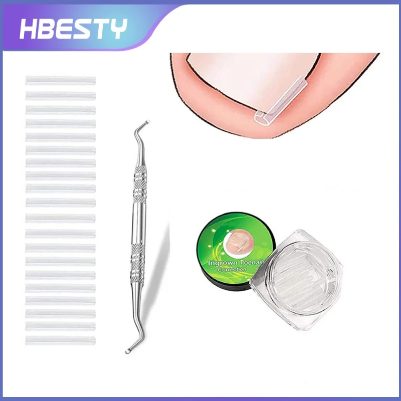 

HBESTY Toe Correction Tool Set for Toe Inflammation