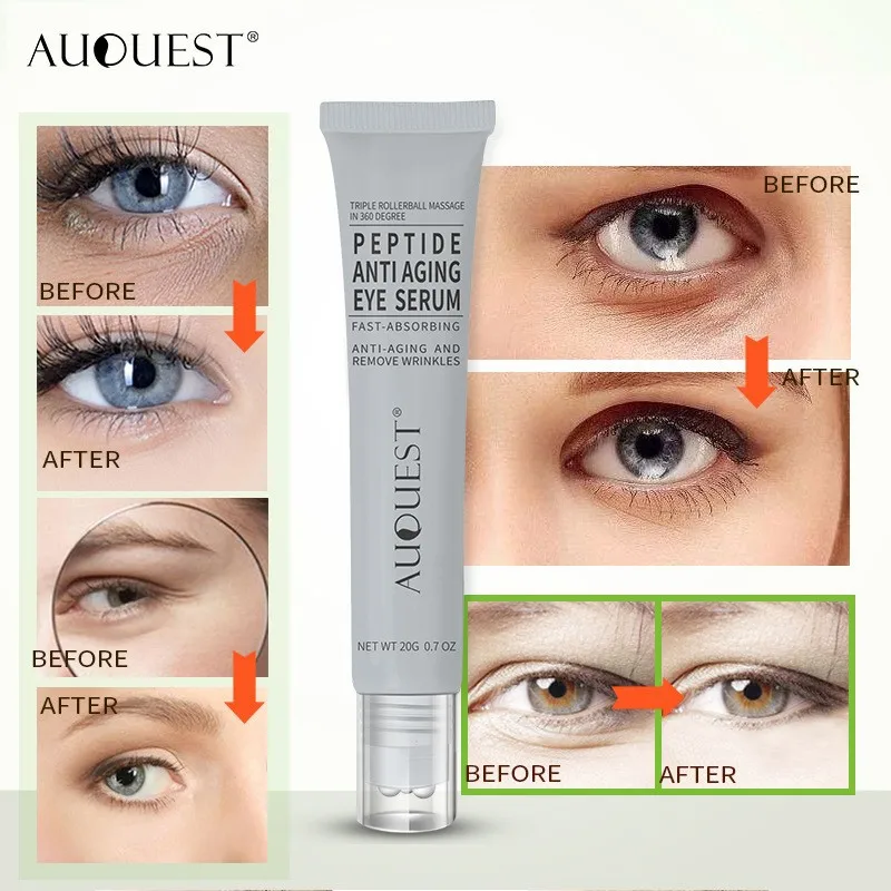 

AUQUEST Eye Cream Polypeptide Anti Dark Circles Wrinkle Cream Reduce Eye Bags Fade Fine Lines Roller Massager Treatment Eye Care