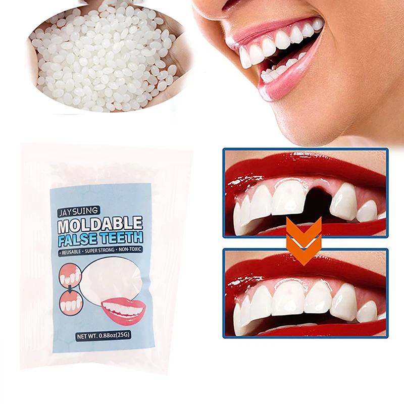 Resina 25G Kit Di Riparazione Dei Denti Temporanei Denti E Spazi Vuoti Denti Finti Colla Solida Protesi Adesiva Sbiancamento Dei Denti Bellezza Dei De
