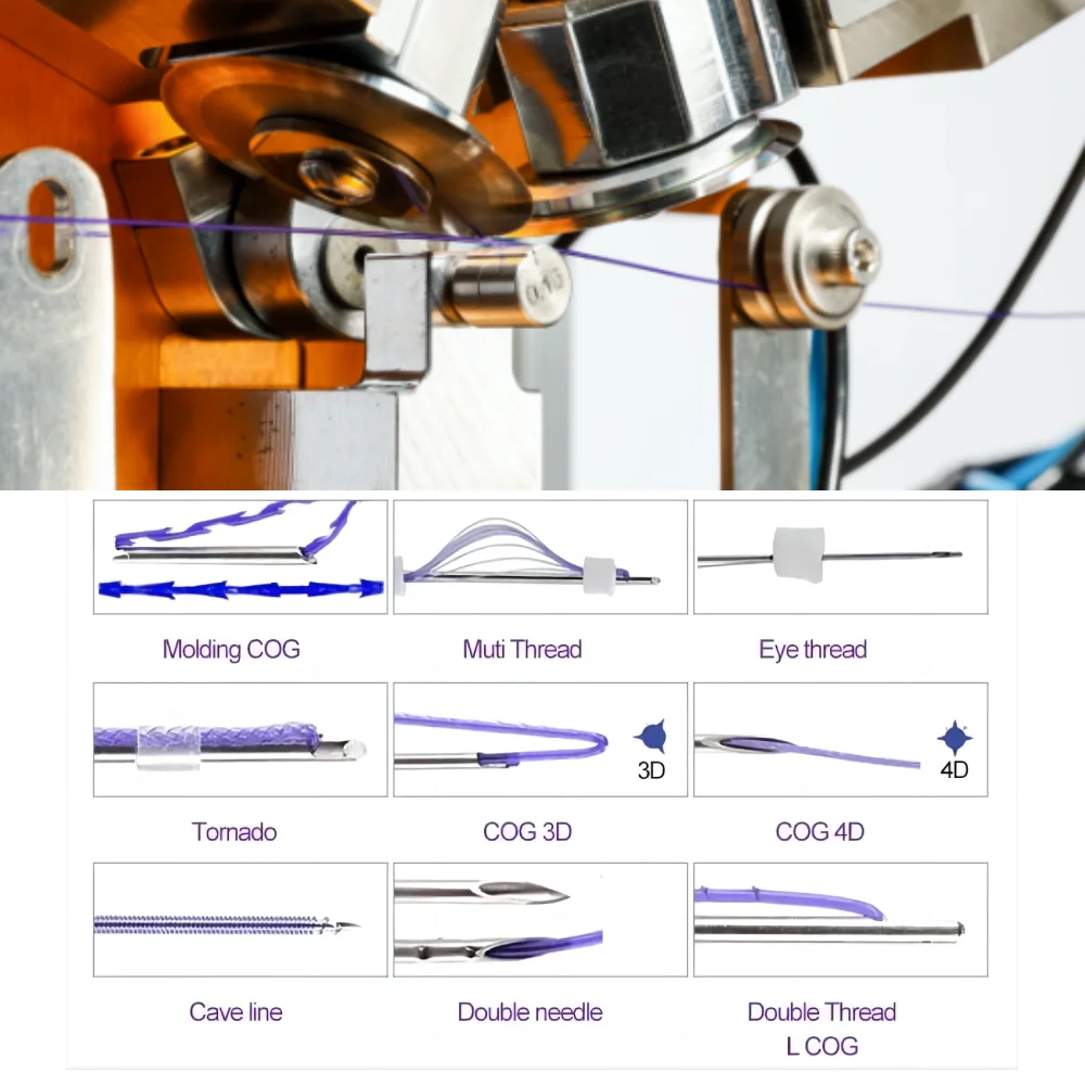 MINERVA PCL Thread Lift 30G MONO / SCREW Sharp Cannula Hilos Pdo Mono